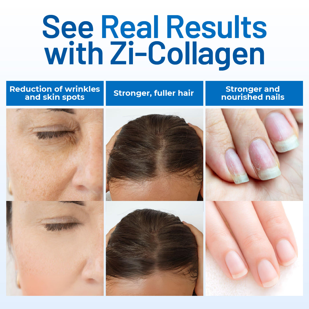 6 Bottles - Zi-Collagen | Save 20% + Free Shipping | Best Value